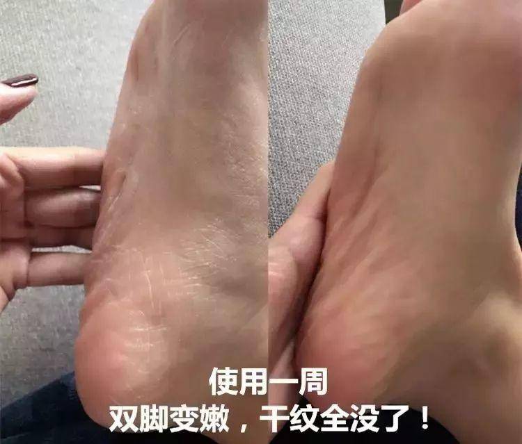 片仔癀紧致抗皱补水提亮水乳,片仔癀适合干性皮肤的面霜