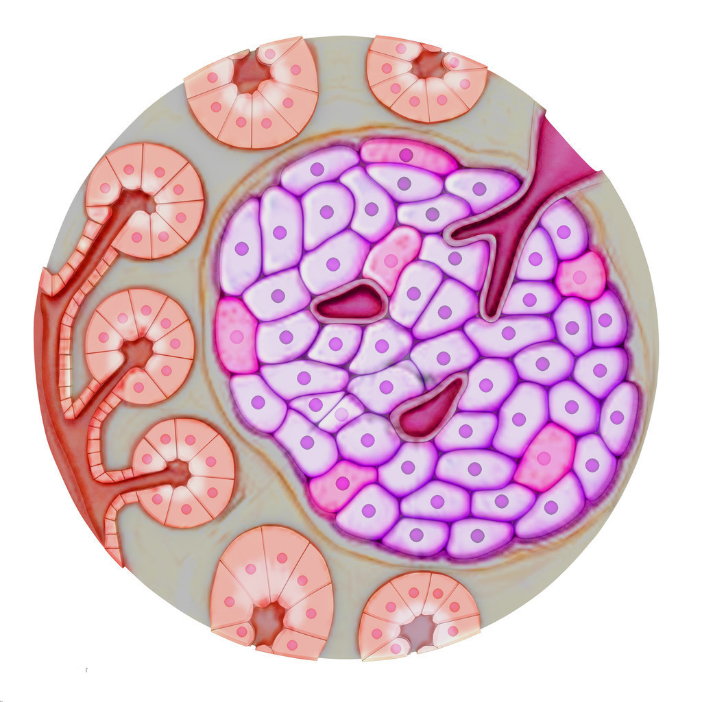 脂肪胰是什么意思,脂肪胰诊断方法