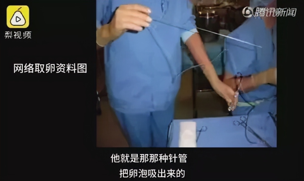 捐卵黑幕,捐卵骗局真人