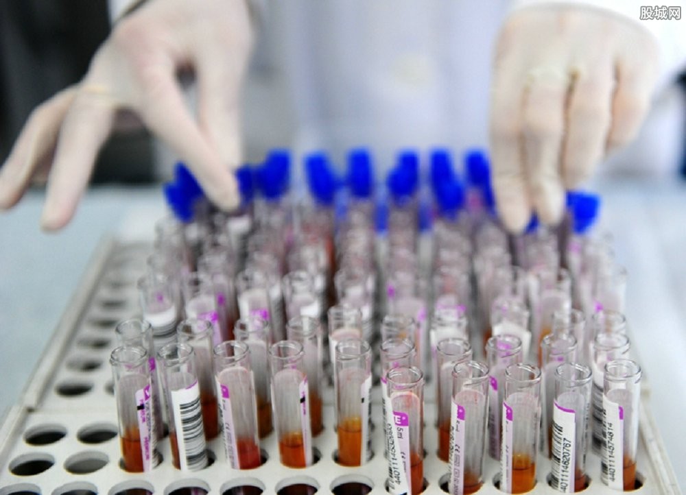 妇科没什么症状要不要做妇科检查,妇科病查哪几个项目就行了