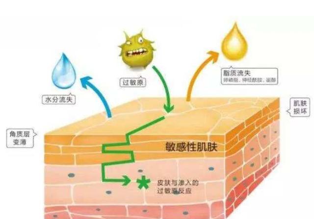敷面膜脸有刺痛感是因为缺水吗,敷面膜脸会刺痛是什么原因