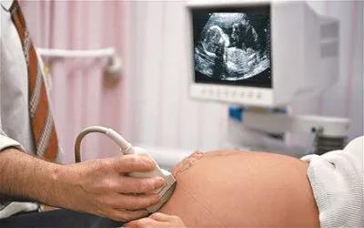 四维老是检查不到心脏,四维彩超通不过是怎么回事