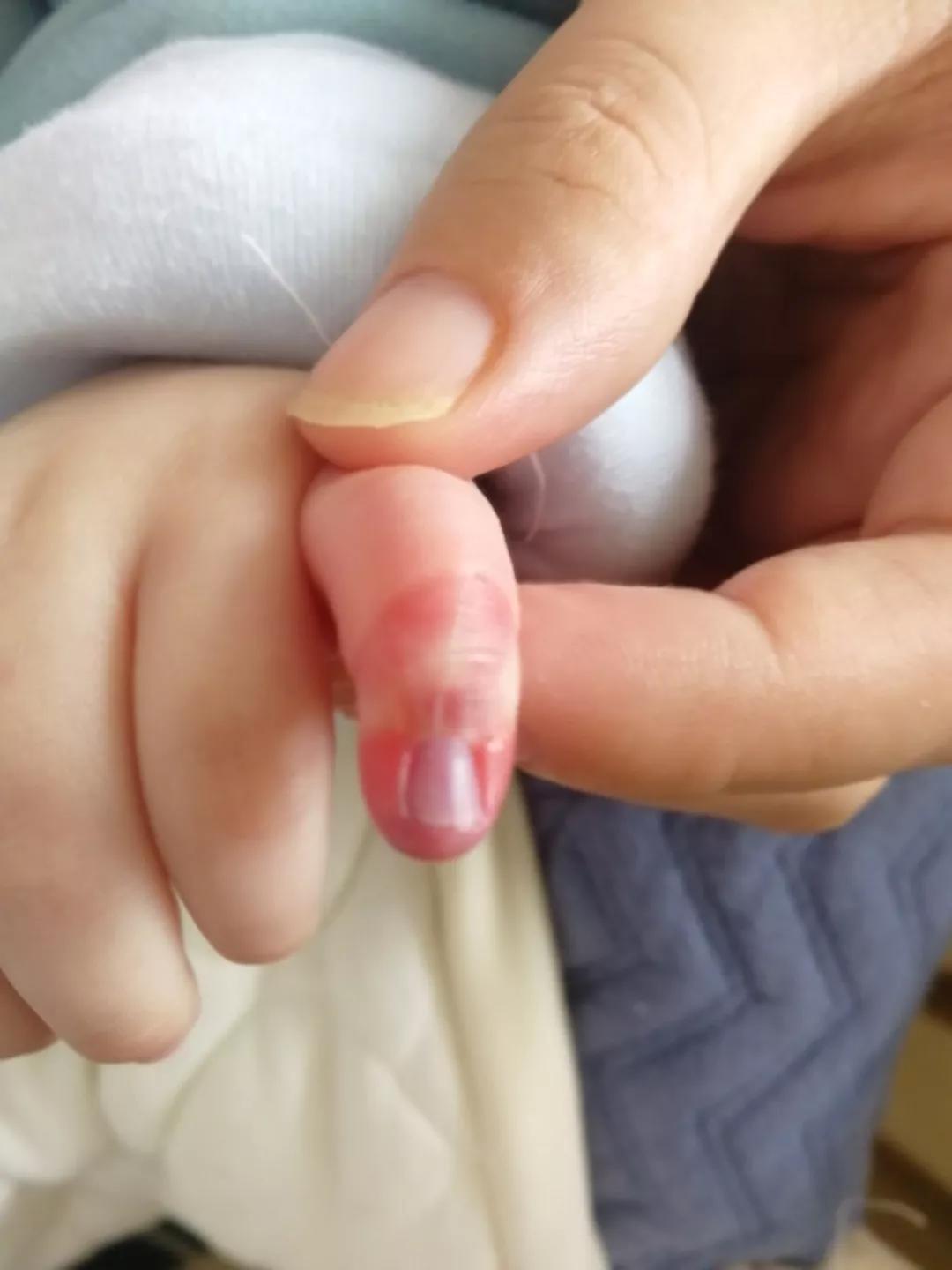 妈妈防止宝宝抓脸面具,出生婴儿防抓脸