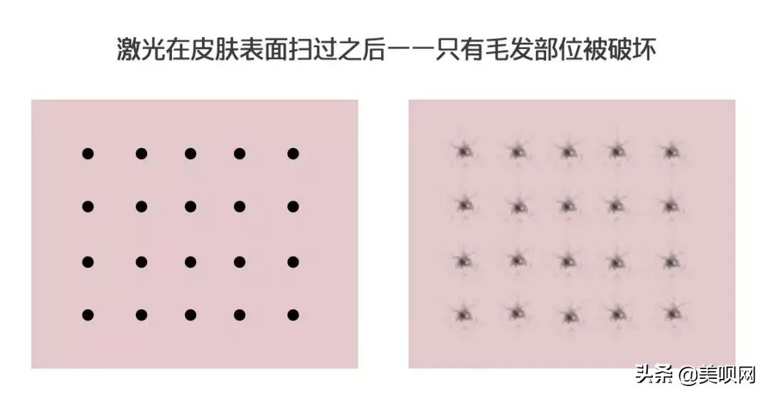 雪莉雀斑妆视频,雪莉伪素颜妆