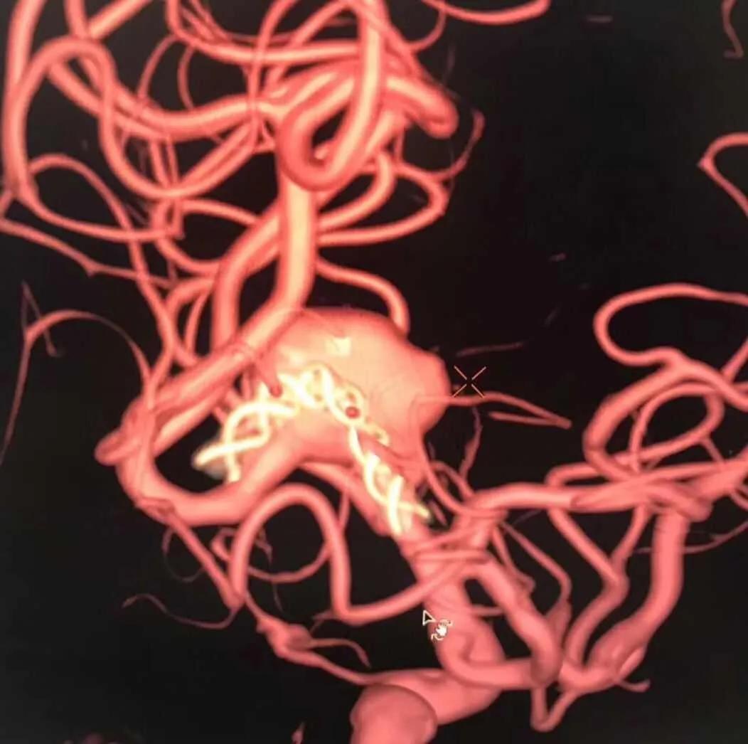 山西省人民医院任少华教授,山西省人民医院任少华