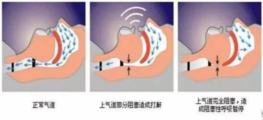 心惊多梦睡不着是什么原因,心惊失眠什么原因引起