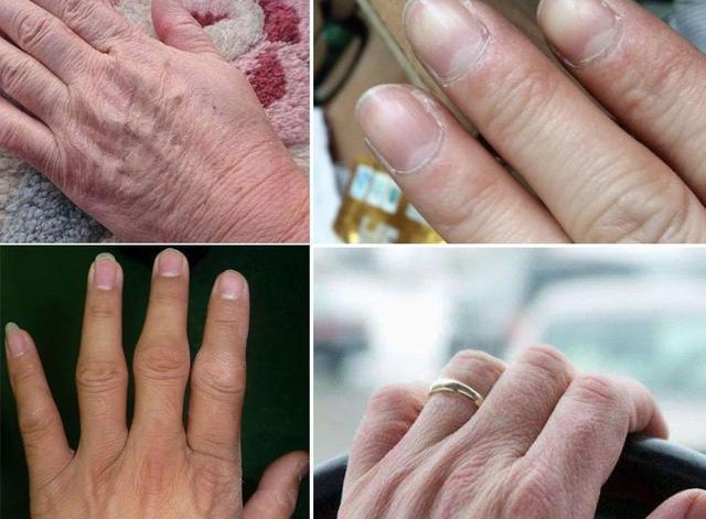 王凯手被投保3600万？林更新堵车时不忘涂手霜，我承认自己不精致