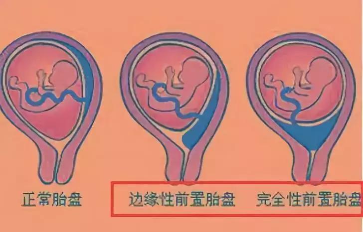 整个孕期，B超究竟都能查出些什么？