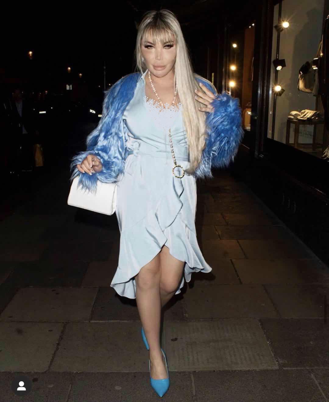 巴西男整容42次图片,巴西男模花数百万整容