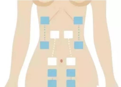 产后肚皮像橘子皮一样,产后肚子圆圆的像个球