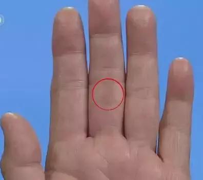 14种常见病的诊断方法,手诊10种常见病从手上就能看出来