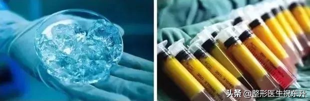 脸不饱满凹陷吃什么,脸大但是脸颊凹陷怎么填充