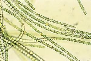 水产养殖藻类老化是怎样的,水产养殖显微镜下各种藻类