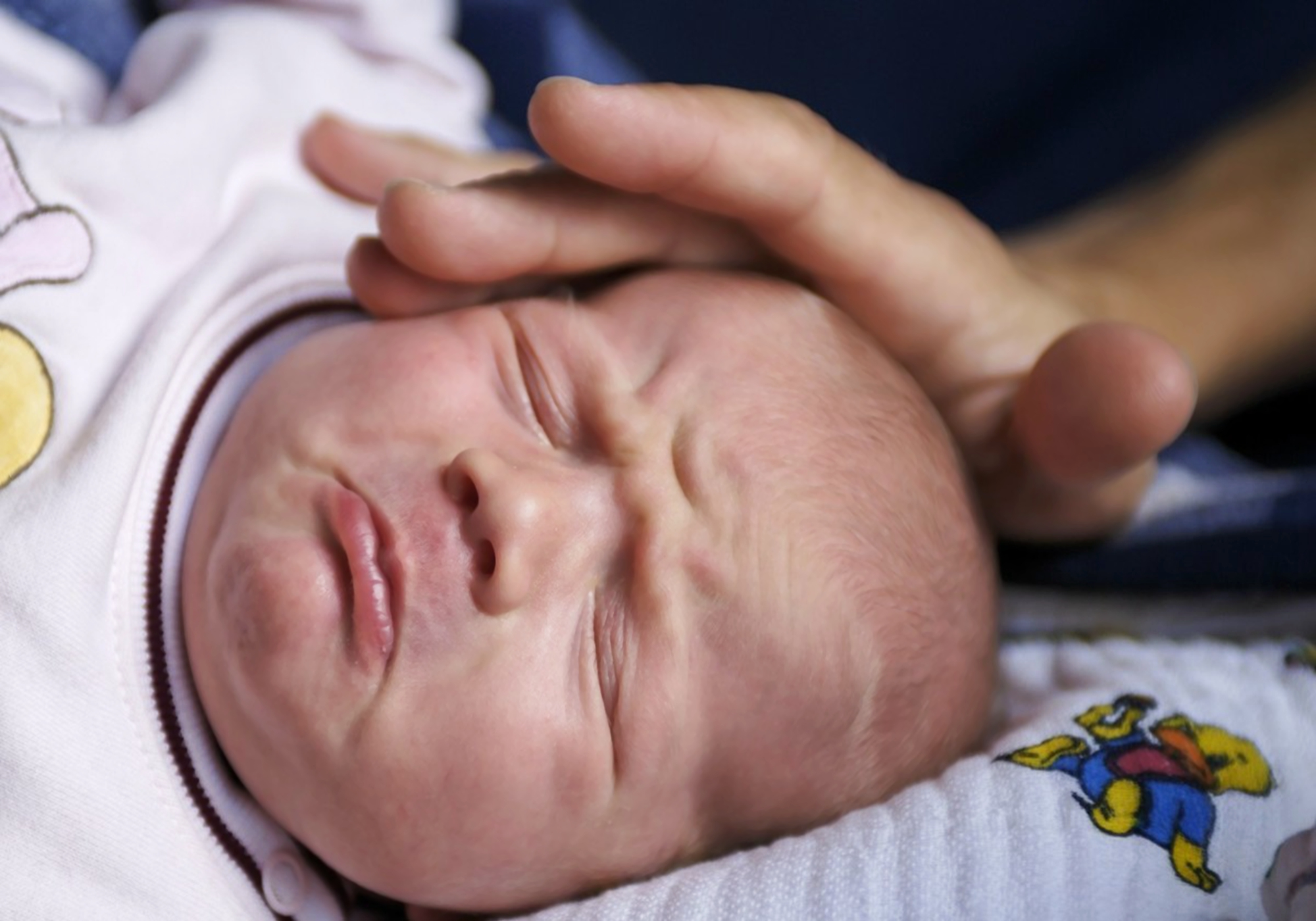 矫正偏扁头哪种枕头好用,成年人偏扁头怎么矫正