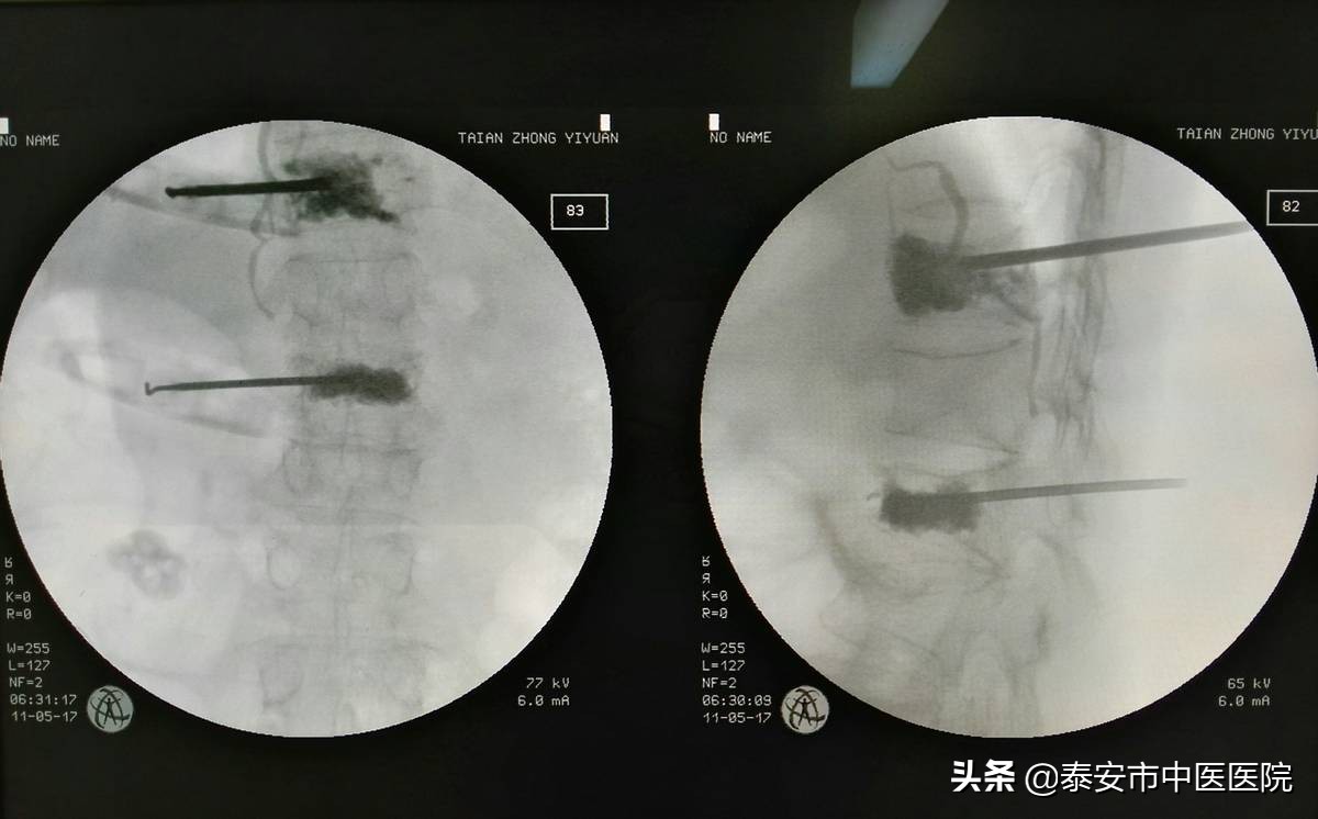 勇担健康新使命续写“骨伤”新担当——记*安泰**市中医医院（*安泰**市骨伤医院）创伤骨科、手足外科