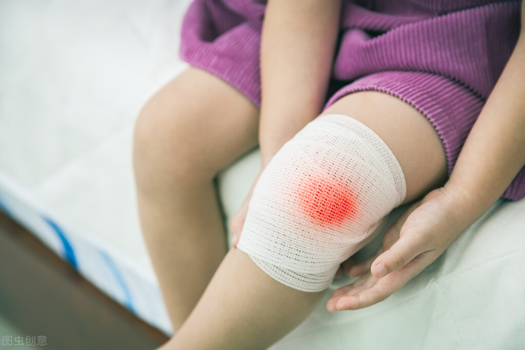 如何正确处理一些小型伤口,复杂伤口的处理