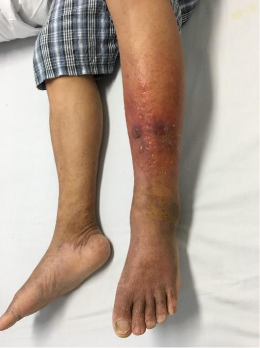 台风暴雨上下班注意安全,台风暴雨来袭出门在外注意安全