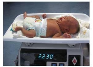 试管婴儿双胞胎有风险吗,试管婴儿产妇风险