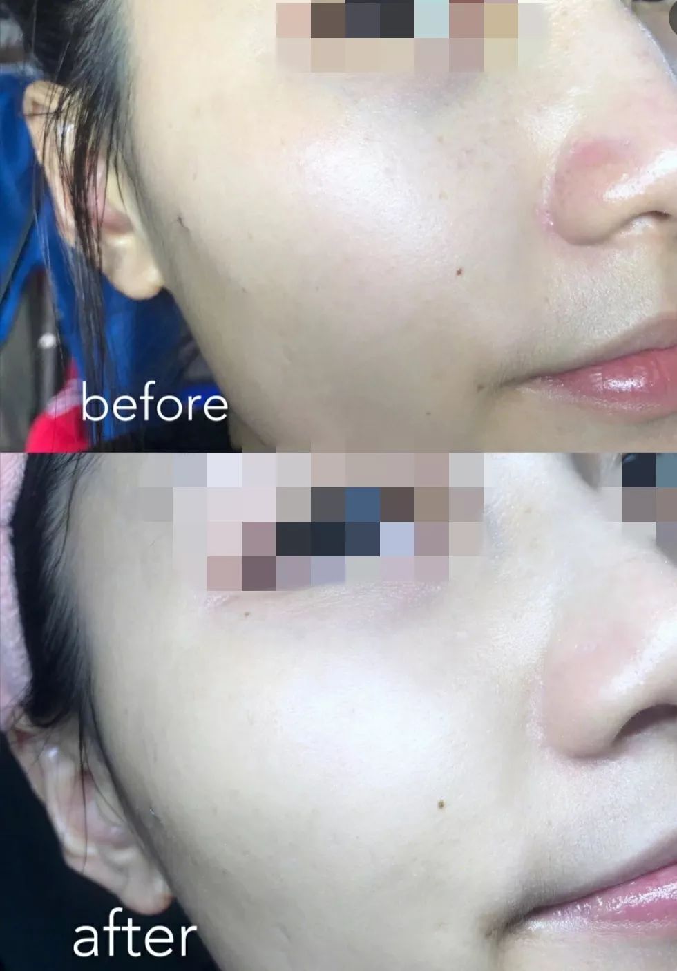 一年四季都能用的保湿面霜,皮肤干推荐一款好用的面霜