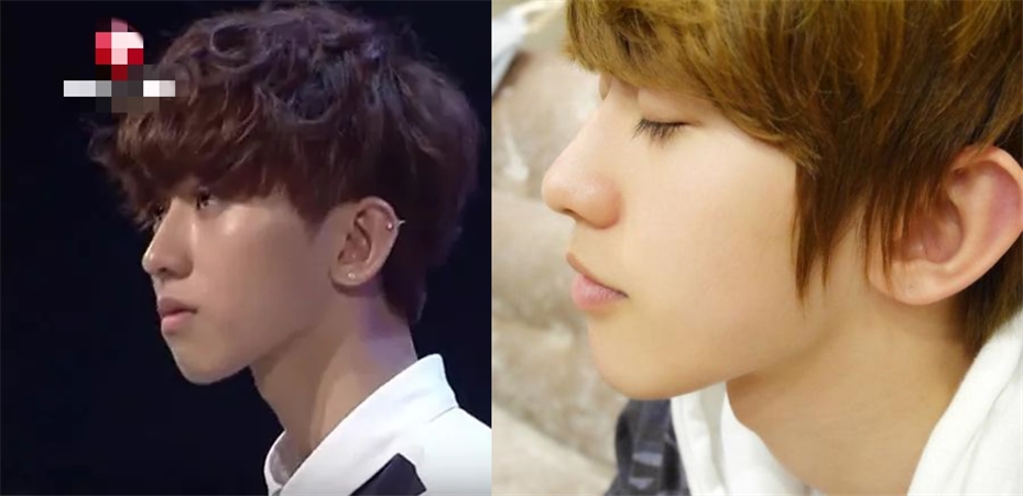 蔡徐坤整牙前后对比图片,蔡徐坤整牙前图片