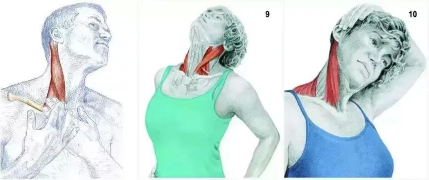 胸锁乳突肌粗大,胸锁乳突肌症状