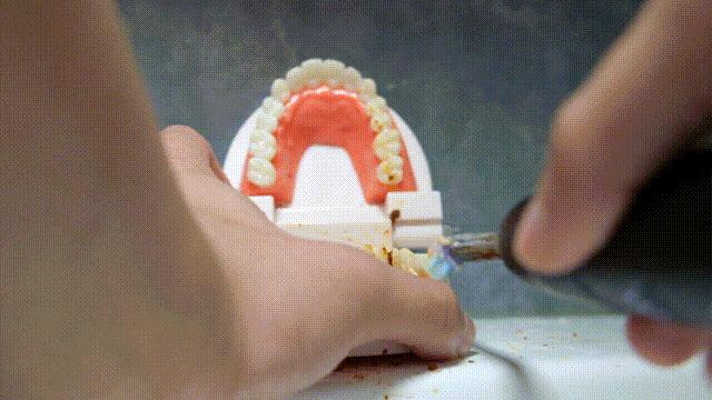 种植牙推荐电动牙刷,根据自己的牙选择电动牙刷