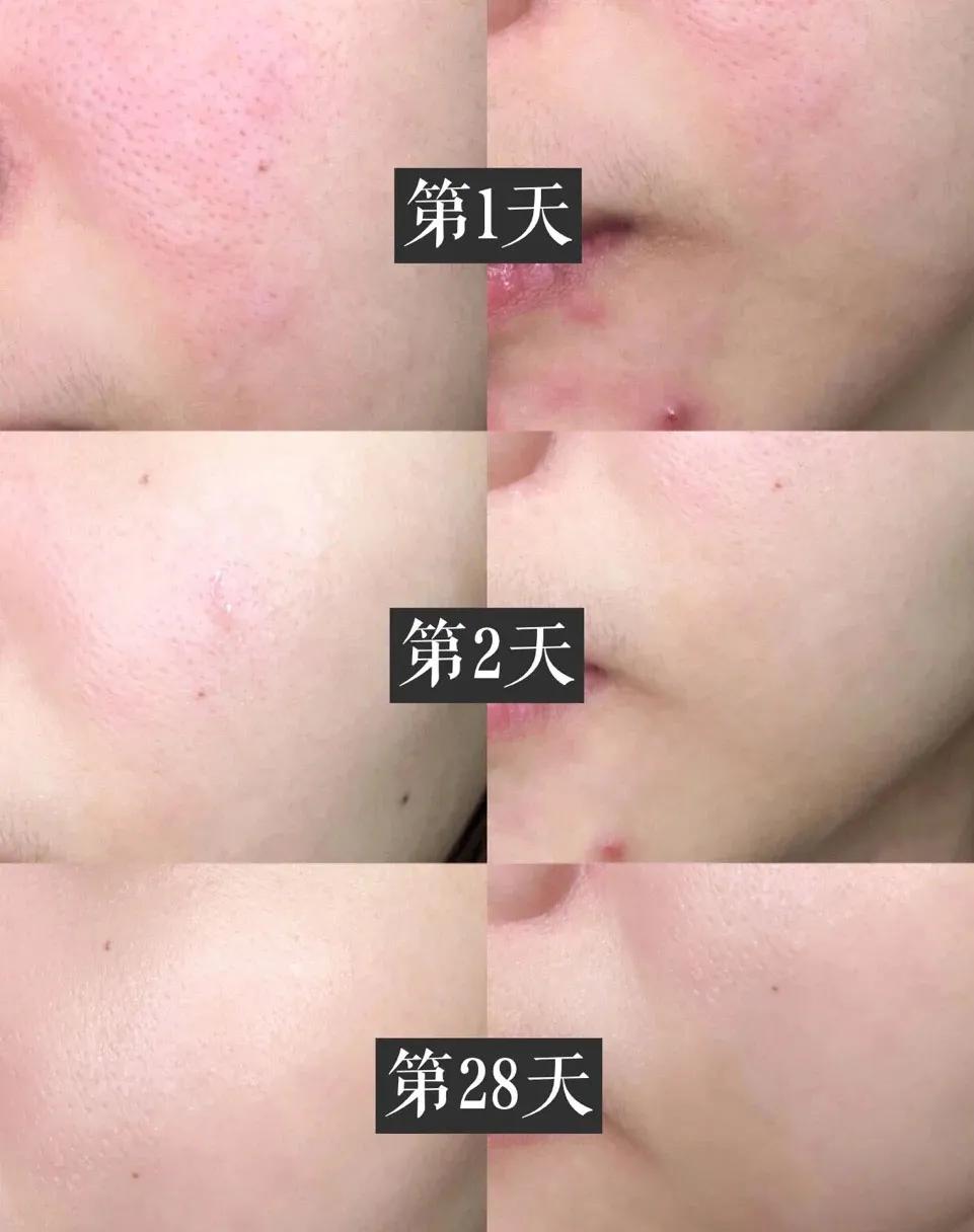 「好评反馈来啦」疯狂打call，实力表白｜为什么*干粉冻**这么受欢迎