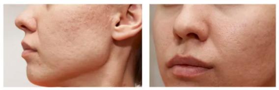 夏天就是要清爽点,男士夏天补水保湿推荐