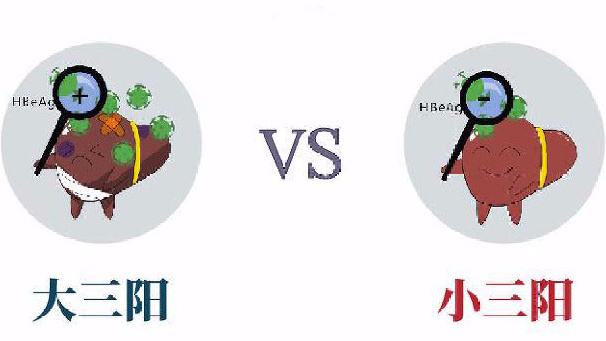 大三阳vs小三阳,肝小三阳和大三阳哪个严重
