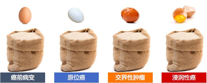 甲状腺癌买重疾险还是不赔,甲状腺癌重疾险最新政策