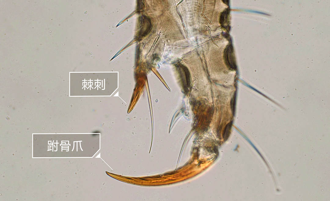 小孩睫毛长阴虱什么症状,6岁女童眼睫毛长虱子