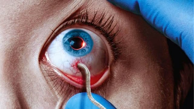 寄生虫电影有虫子吗,铁线虫会寄生人吗电影片段