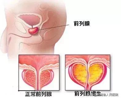 难言之隐1-40集完整版合集,难言之隐第十集完整版