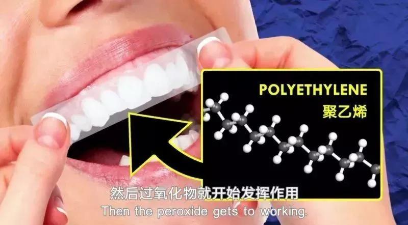 冷光美白牙齿危害亲身经历,牙齿美白科普篇