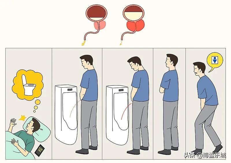 前列腺热疗消融技术只需8分钟让前列腺增生不再是“男题”