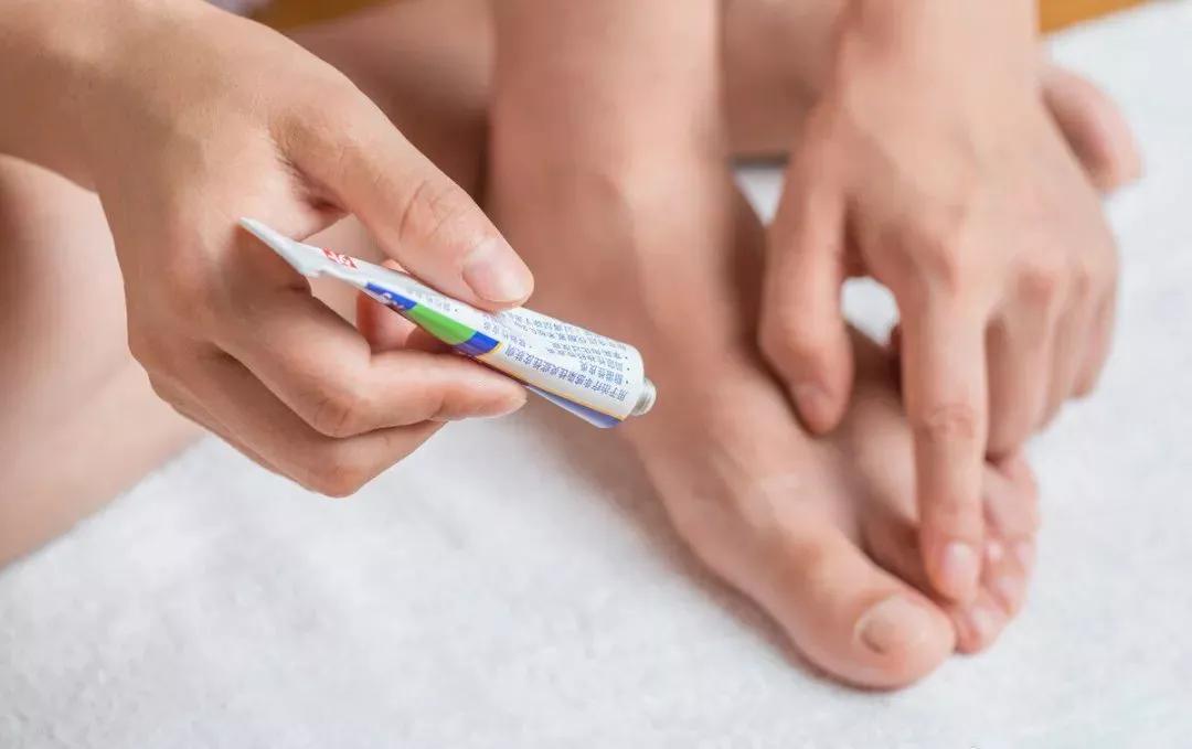 天气一热脚就脚臭？教你5招，远离脚气