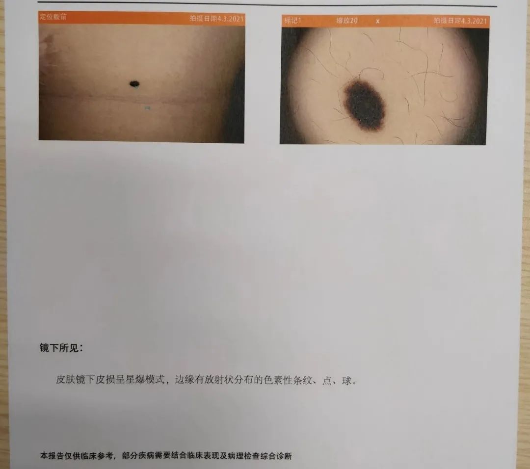 让你悄悄变美的4个小细节,让你偷偷变美的三种药膏