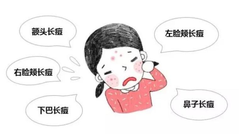 祛痘坑修复凹洞产品测评,祛痘产品良心测评