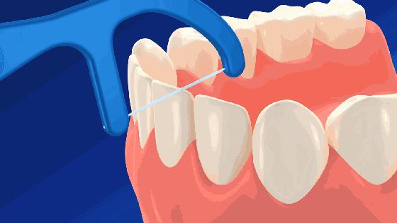 牙线的正确使用方法视频动画片,水牙线正确使用方法视频