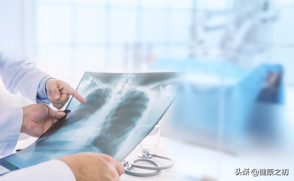 没手术的肺癌患者几年过危险期,肺癌患者没治一般活多久