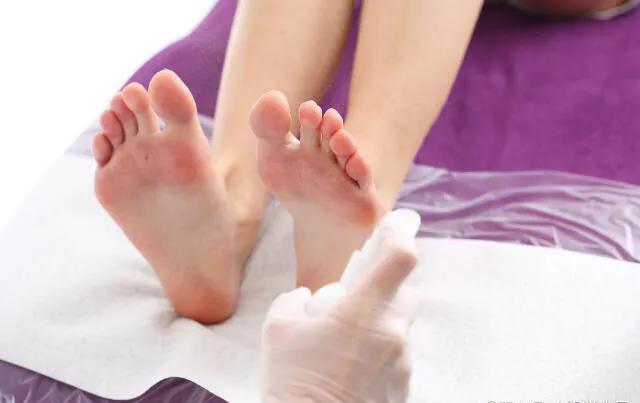 脚气脚怎么修,治疗脚气足癣的方法