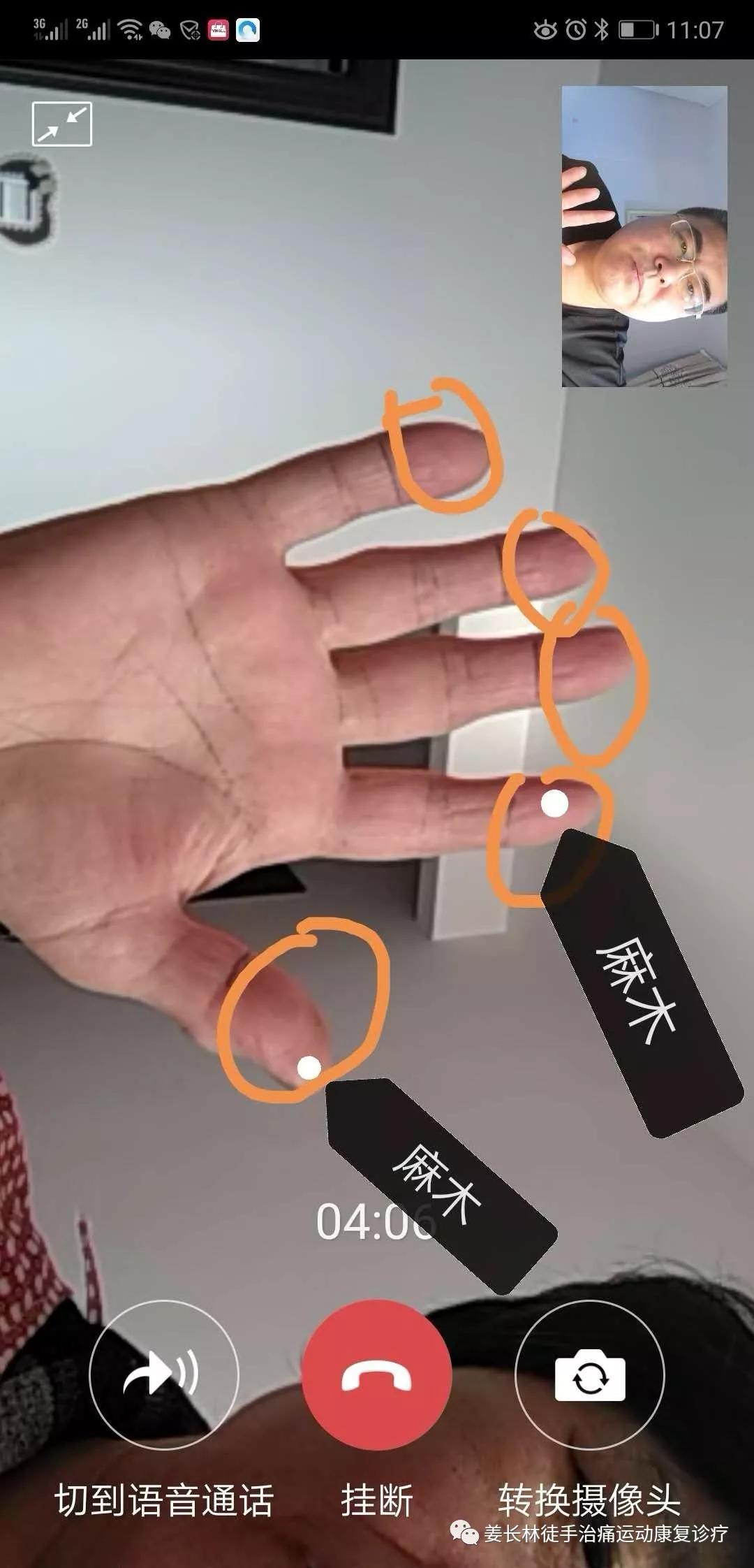 日常生活中的疼痛1—手麻（长时间玩手机）的判断和自我纠正