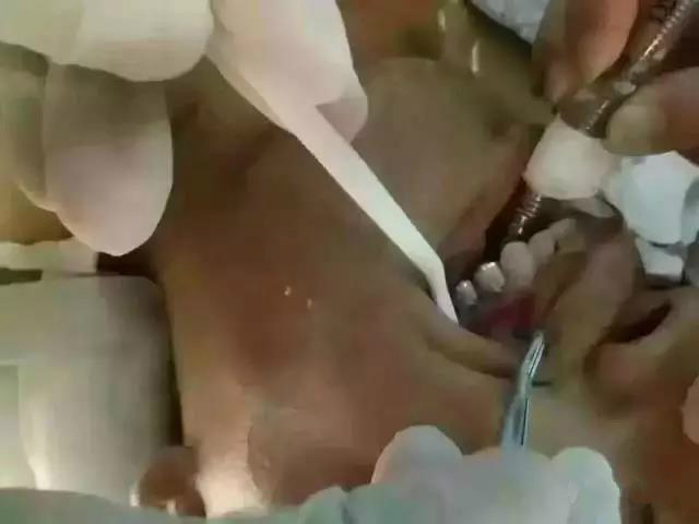 二氧化锆牙齿能做ct和核磁共振吗,氧化锆全锆牙冠能做核磁共振吗