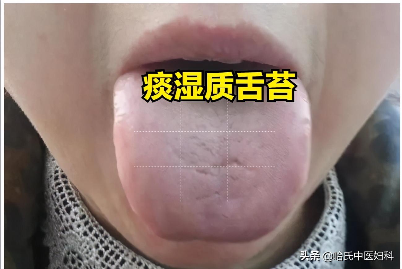 多囊卵巢综合征怀孕多久能测出来,多囊卵巢综合征怀孕了容易流产吗