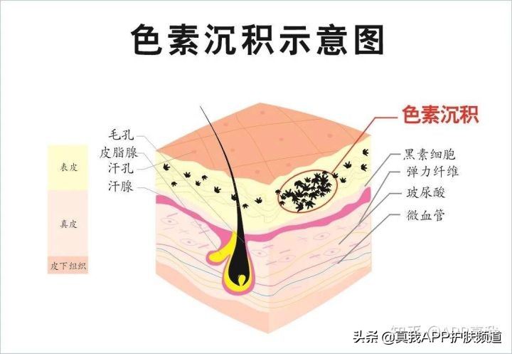 全球最好用的五款去痘印产品！每一款都火爆全网，有没有你用过的
