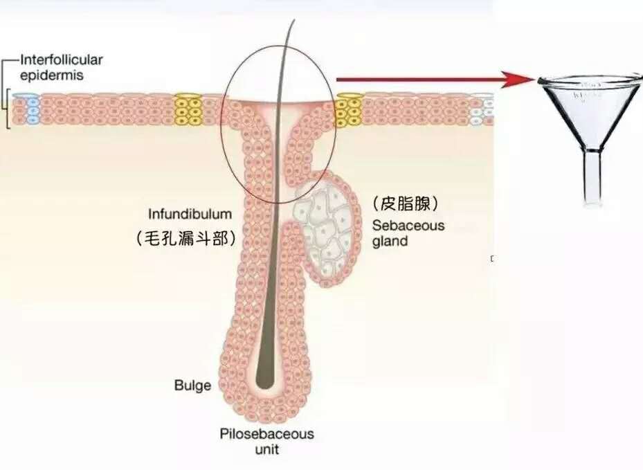 小孩脸上长脂肪粒用什么药消除,16岁男孩脸上长脂肪粒怎么处理