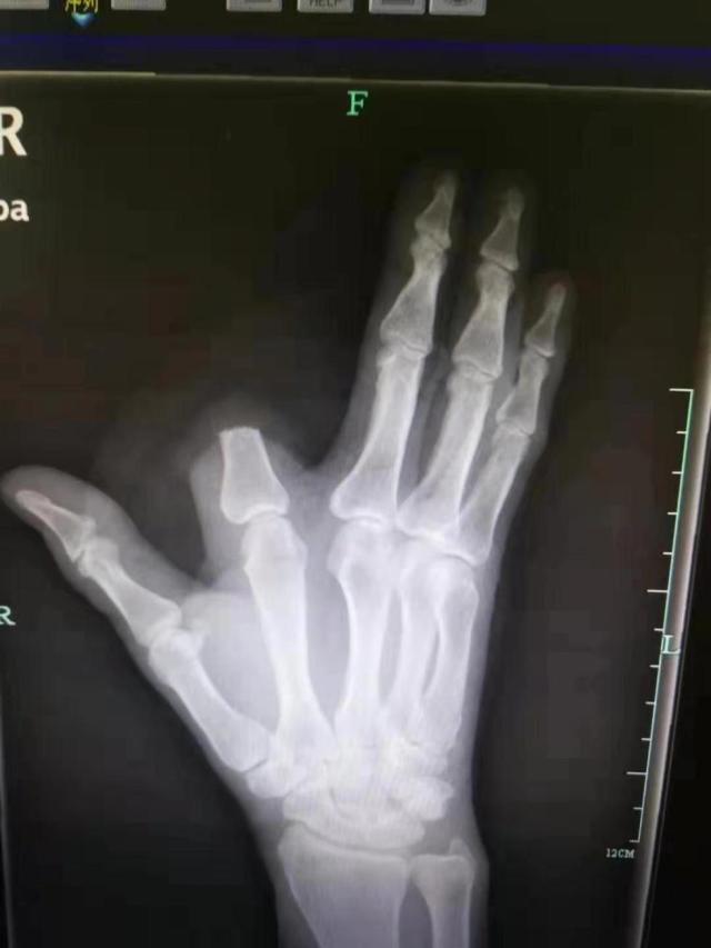 为什么家里进蛇不能打看完涨知识,家里进蛇怎么办蛇怕什么