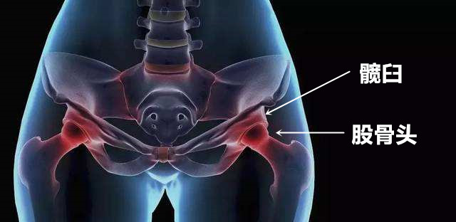 胯骨疼是不是骨折,胯骨疼是什么原因股骨头坏死