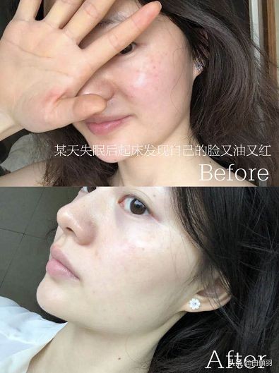 公认最好的抗氧化精华,抗氧化比较好的高档精华