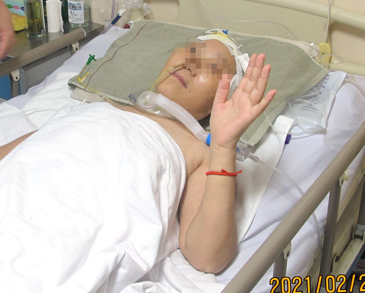 脑脓肿合并脑膜炎需要手术吗,脑脓肿进入左侧脑室严重吗